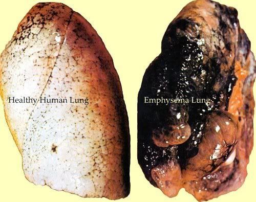 smoking lungs and healthy lungs. see what healthy lungs vs