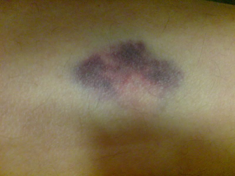 Image Hosted by PhotoBucket.Com