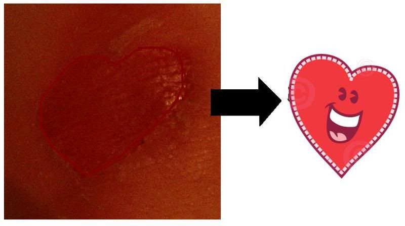 funny blister
