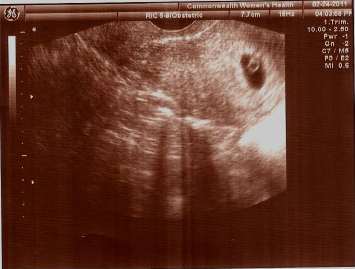 Fetal pole or beating heart @ 6 weeks? — The Bump